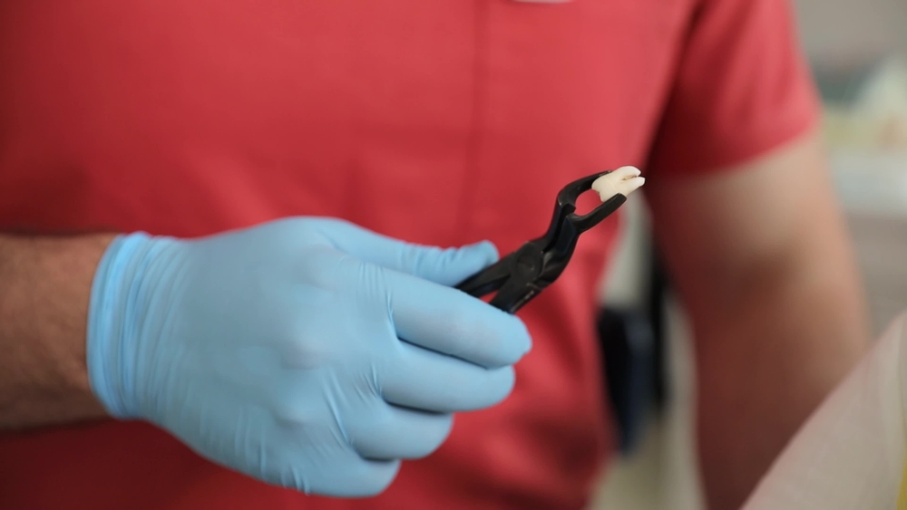 when is tooth extraction necessary five common reasons explained